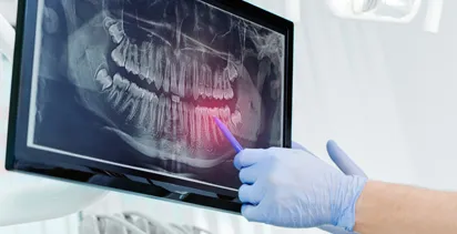 Digital-X-Rays
